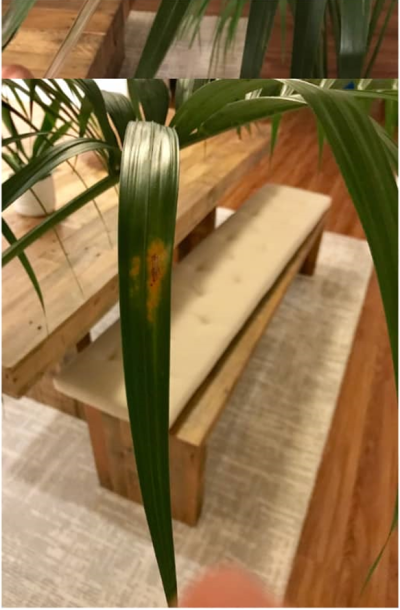 بیماری کنتیا